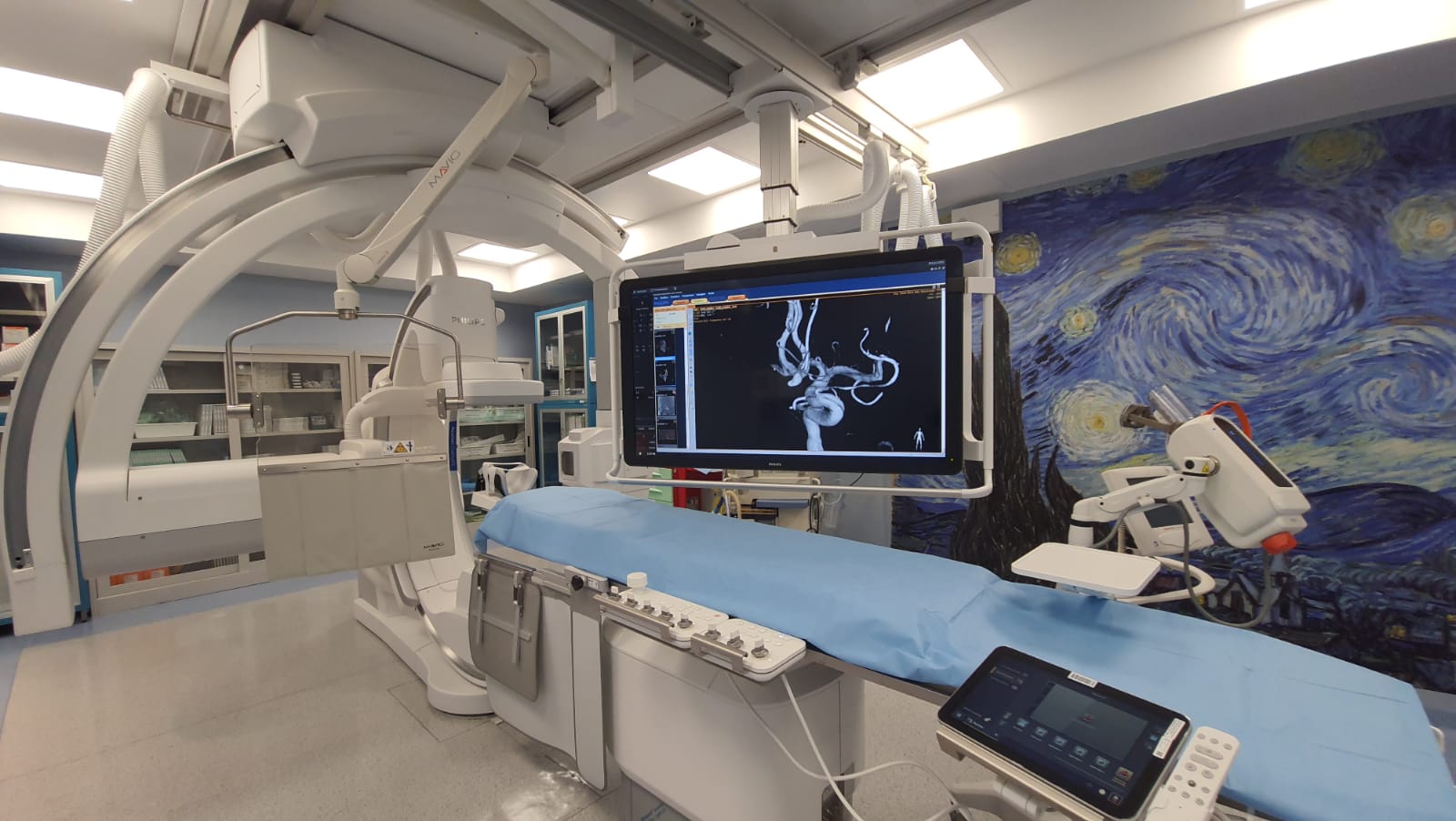 OSPEDALE PERUGIA NUOVO ANGIOGRAFO BIPLANO AD ARCO