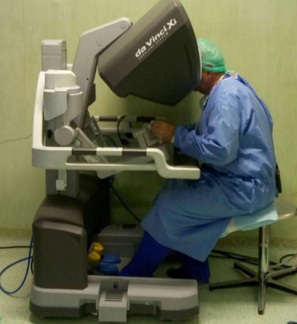 robot da vinci ospedale perugia2