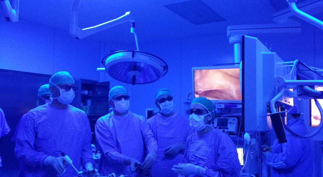 Intervento in laparoscopia 3Dp