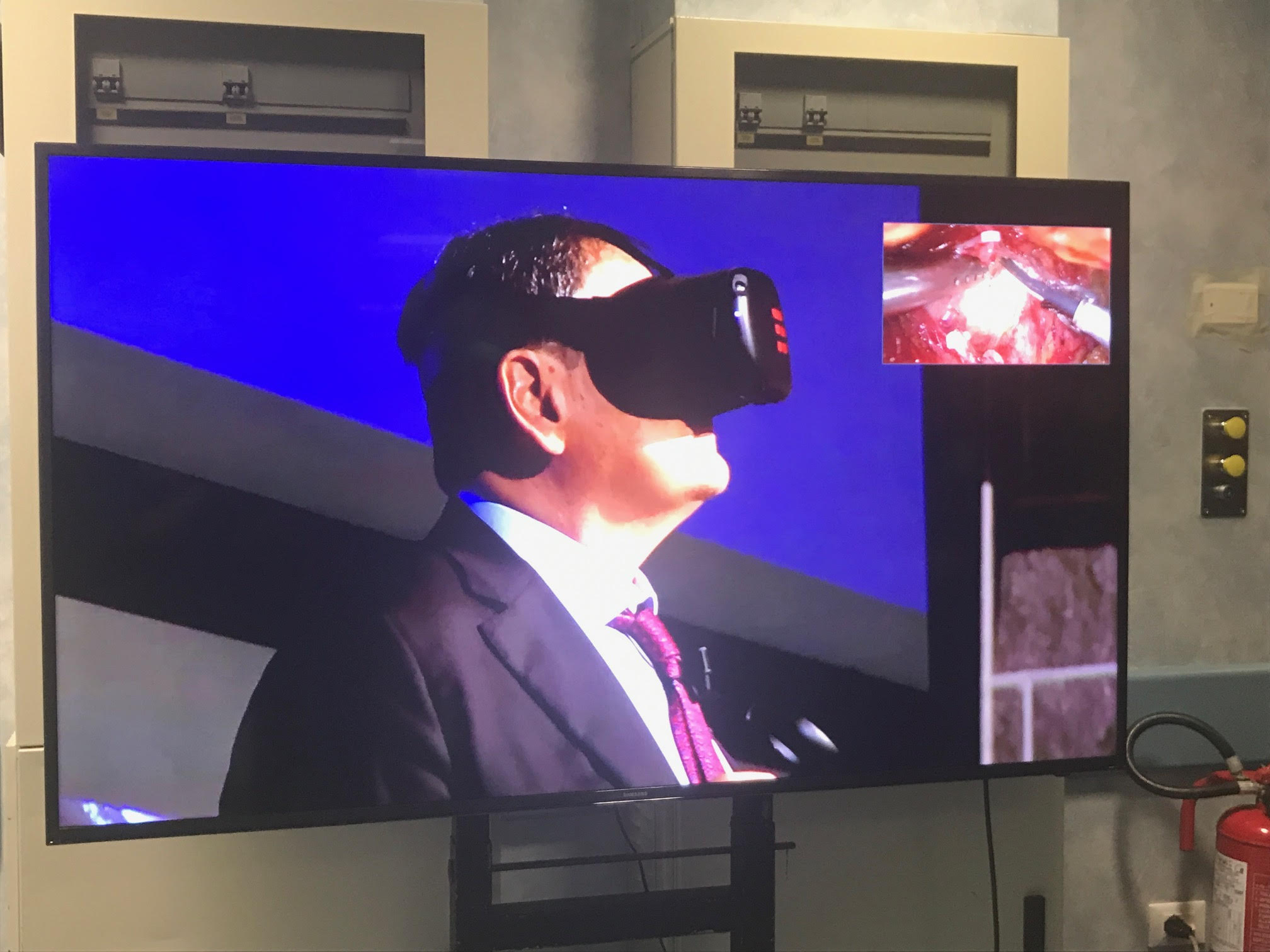 2019 11 28 aospternilivesurgery 5G 4